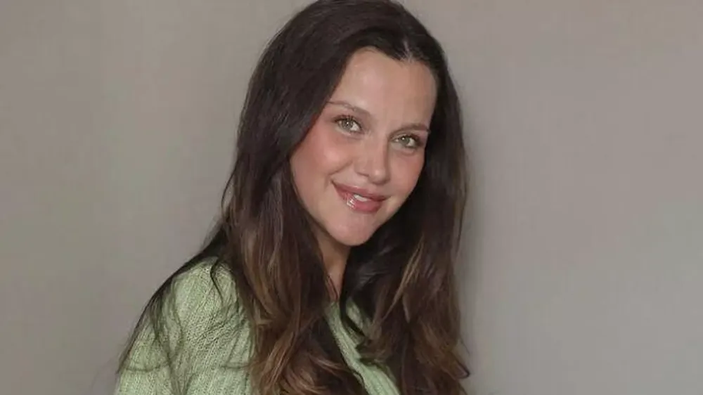 OYUNCI İREM HELVACIOĞLU TRAFİK KAZASI GEÇİRDİ